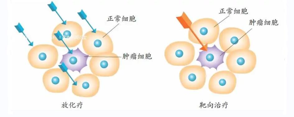 肺癌中药治疗好还是靶向治疗,靶向治疗同时可以吃中药吗