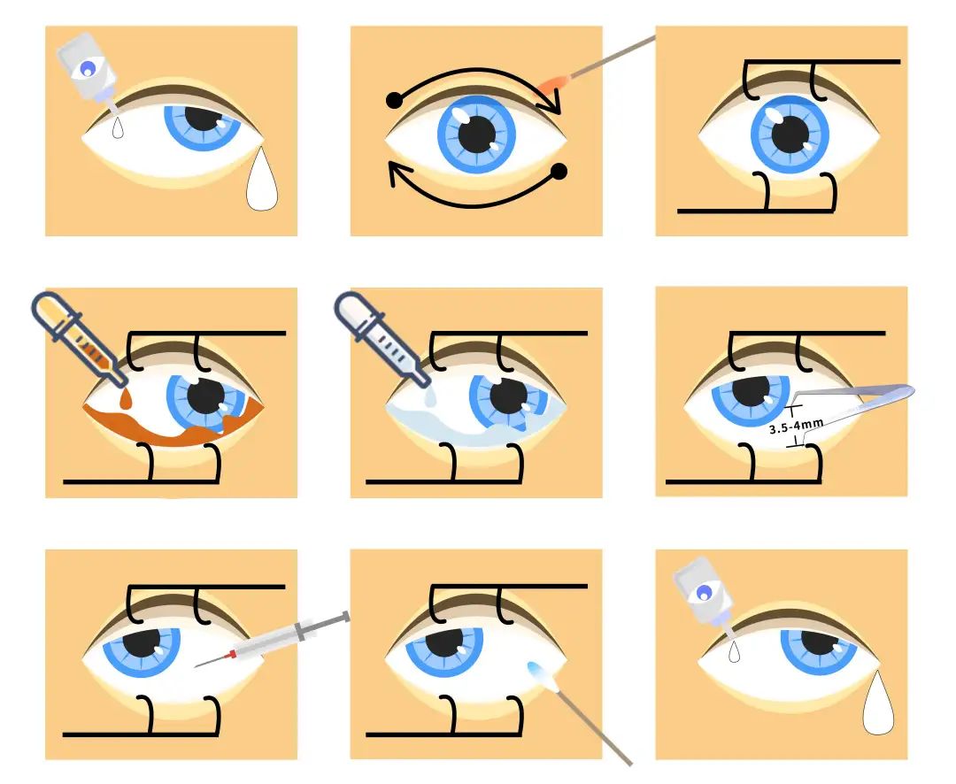 视力下降要如何治疗呢,什么药物可以导致视力下降