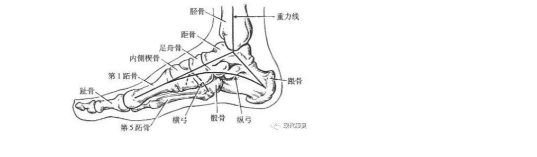 扁平足发病机制,扁平足诊断标准示意图
