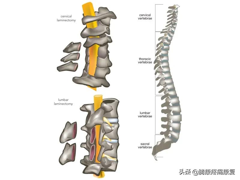 平背的成因,平背怎么造成的