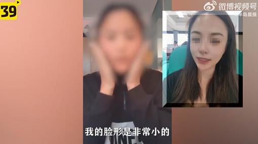 大连女孩打美容针毁容,大连一女子打玻尿酸