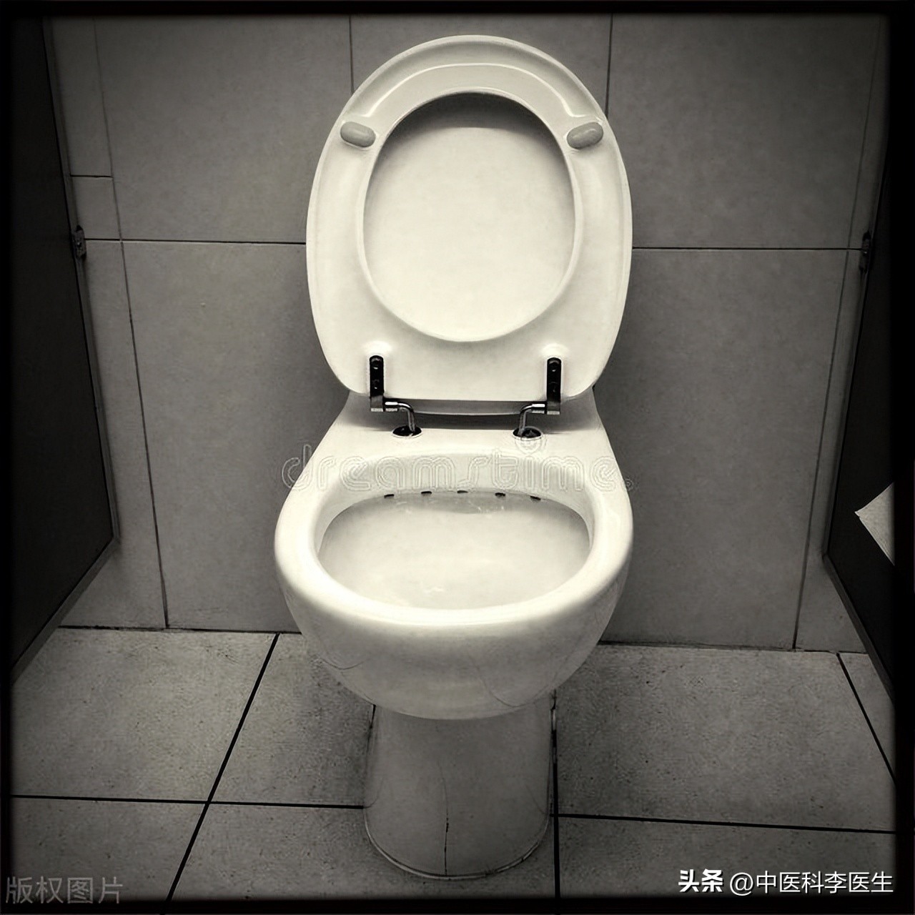 下体瘙痒发现两三只阴虱严重吗,阴部有几十只阴虱