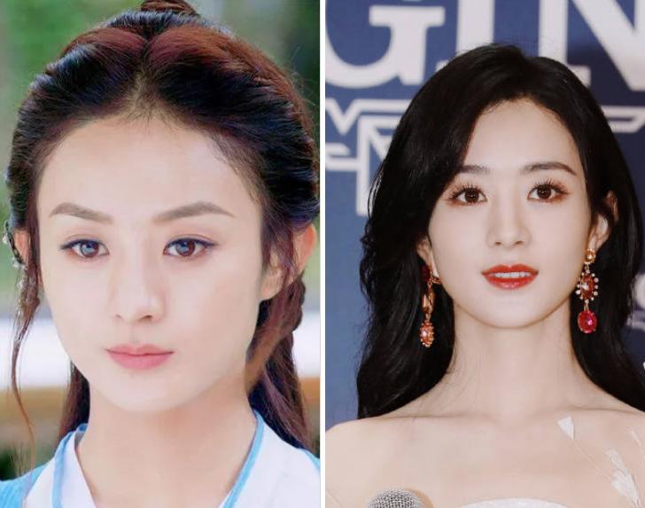 眉毛不对称怎么办可以整容吗,脸圆眉毛淡怎么修剪