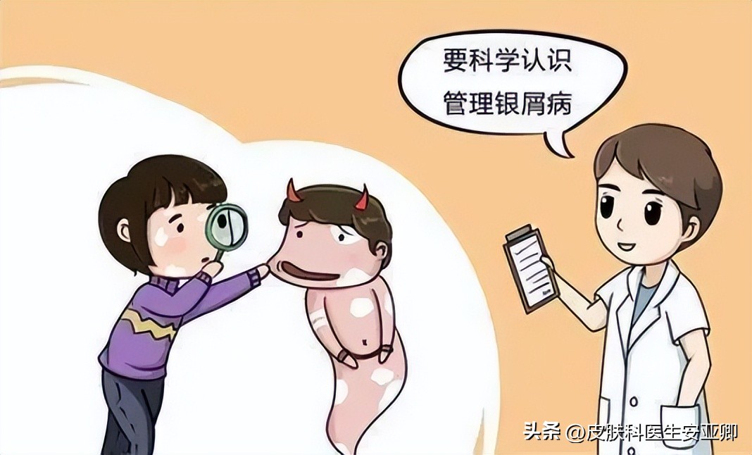 外阴银屑病不治会怎样,副银屑病不治会下去吗