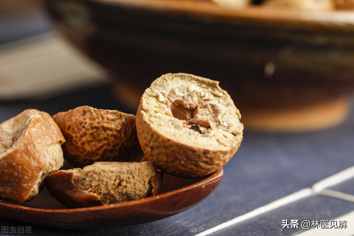 精索静脉曲张小腹坠胀感,湿热下注气滞血瘀精索静脉曲张