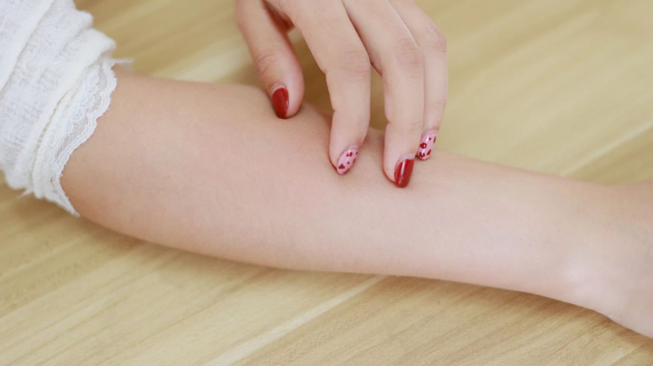 过敏性皮炎注意事项有哪些,过敏性皮炎的症状表现有哪些