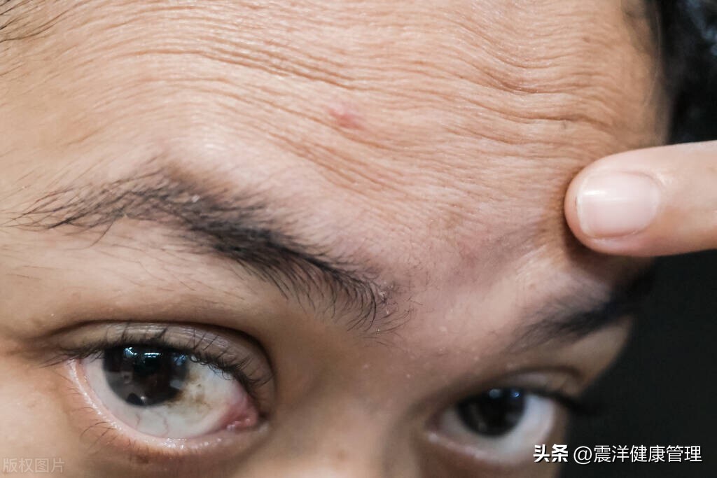 私密处的毛毛有什么用？能剃吗？对人体有3种作用，涨知识