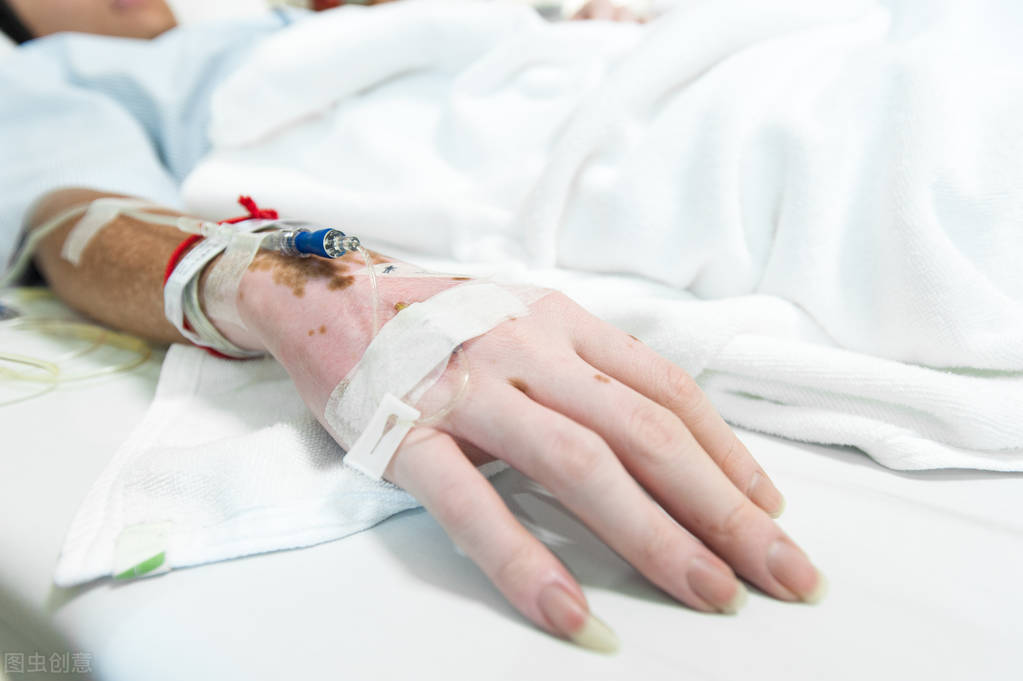 男性白癜风怎么治疗更有效,男性白癜风怎么治疗效果好