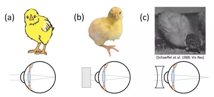角膜塑形镜控制度数的原理是什么,角膜塑形镜控制近视度数增长
