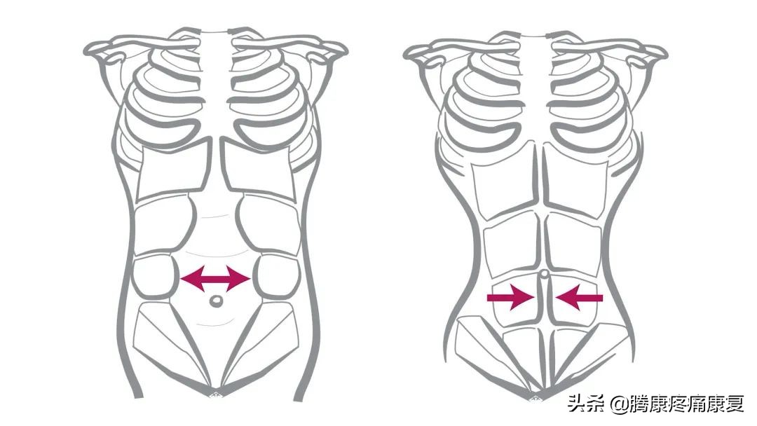 产后腹直肌分离康复训练方法,腹直肌分离的康复动作