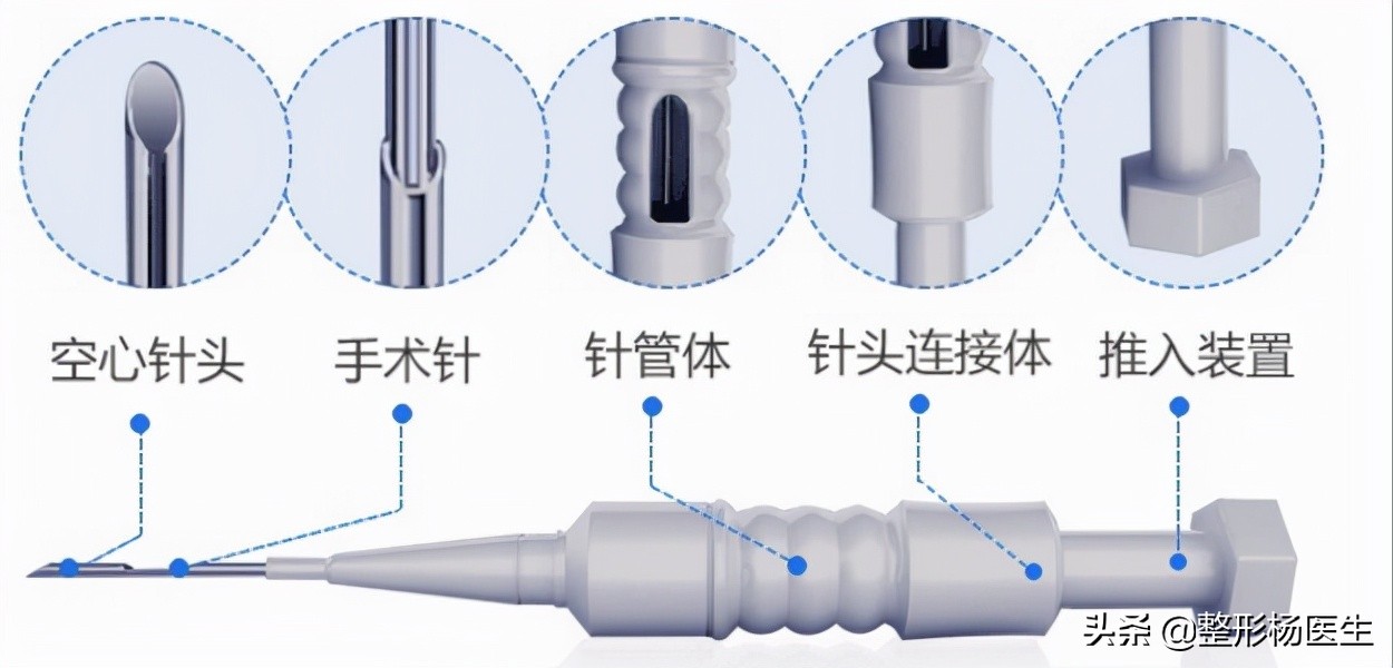 微针植发的优点和缺点,微针植发哪家靠谱