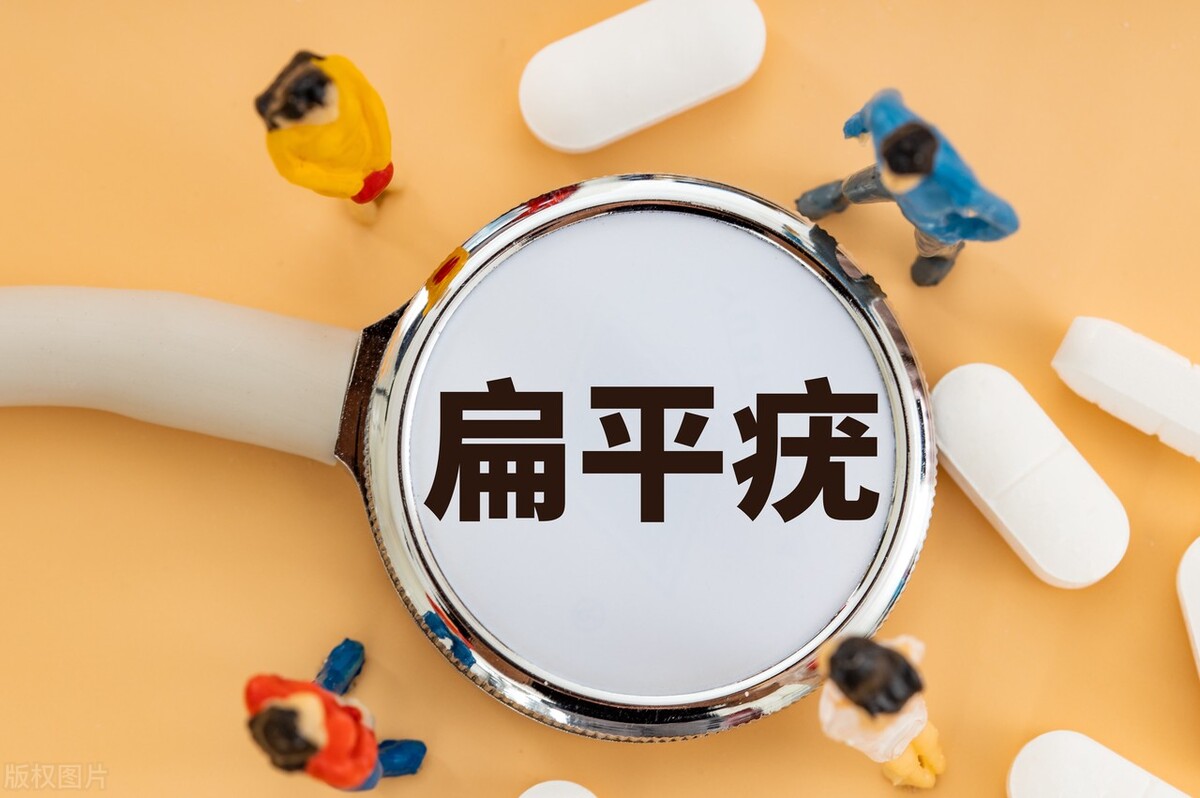 得了扁平疣有哪些治疗方法啊,手背上长扁平疣最有效的治疗