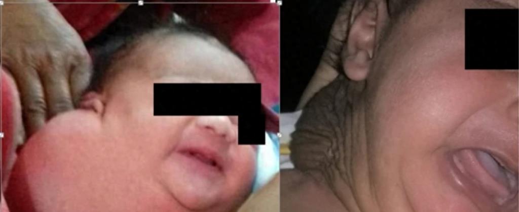 美国婴儿女孩,美国女婴身体患绝症