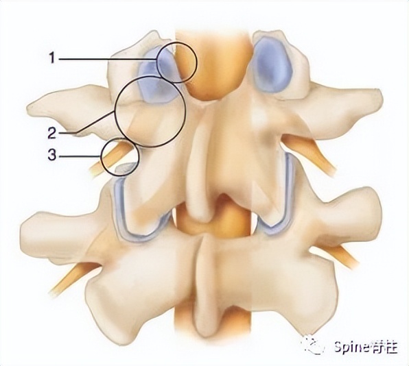 腰椎间盘突出下肢放射痛严重吗,下肢放射疼痛是间断性严重吗