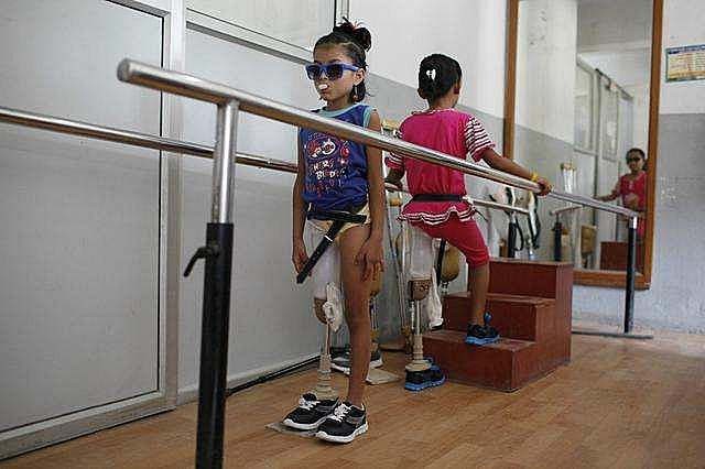 小腿巨粗的女孩,河南女子患病腿粗如大象