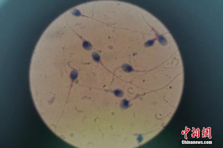 有没有男用长效避孕药,男用口服避孕药药店有卖的吗