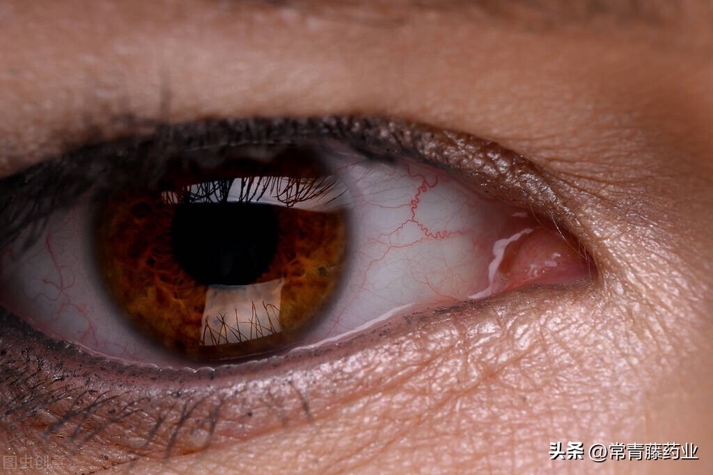 晚上看不清路是夜盲症吗,视网膜病变引起的夜盲症怎么治疗