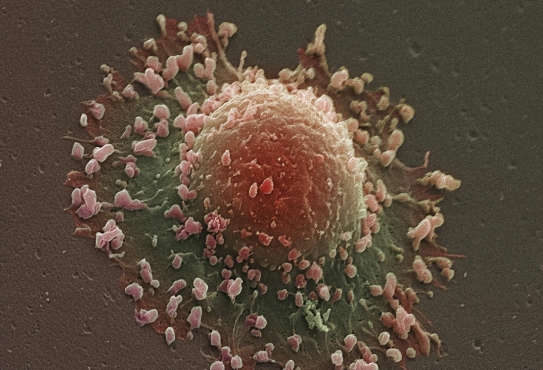 得过肿瘤的人还会再得么,得了肿瘤是不是就死定了