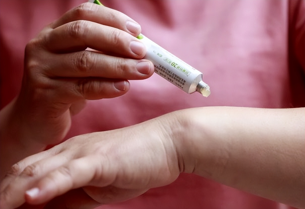 老人为什么长老年斑,红霉素软膏能祛老人斑吗