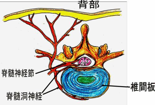 腰椎间盘突出吃了草药反而更疼,腰椎间盘突出煎熬