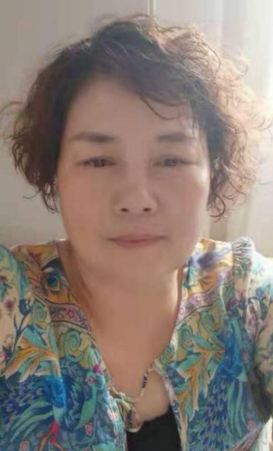 安徽中医张正天,张正天治疗银屑病真的假的