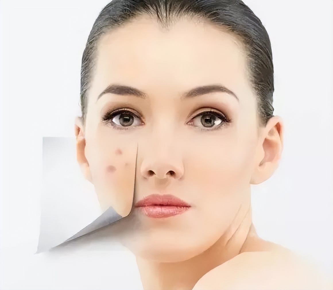 化妆过敏是怎么样的,化妆品过敏后用什么补水护肤