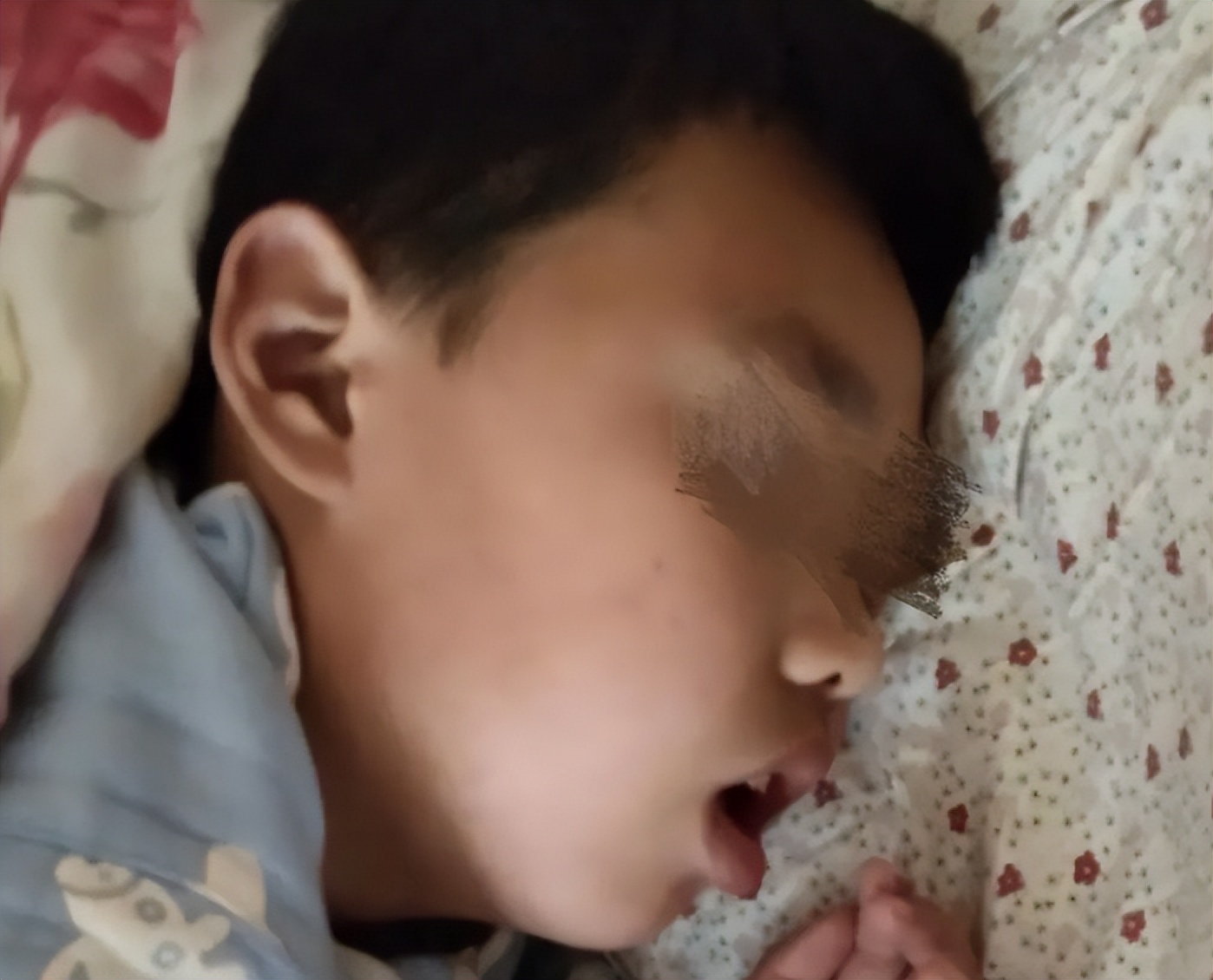 男孩打呼噜有什么好方法治疗吗,17岁的男孩打呼噜怎么回事