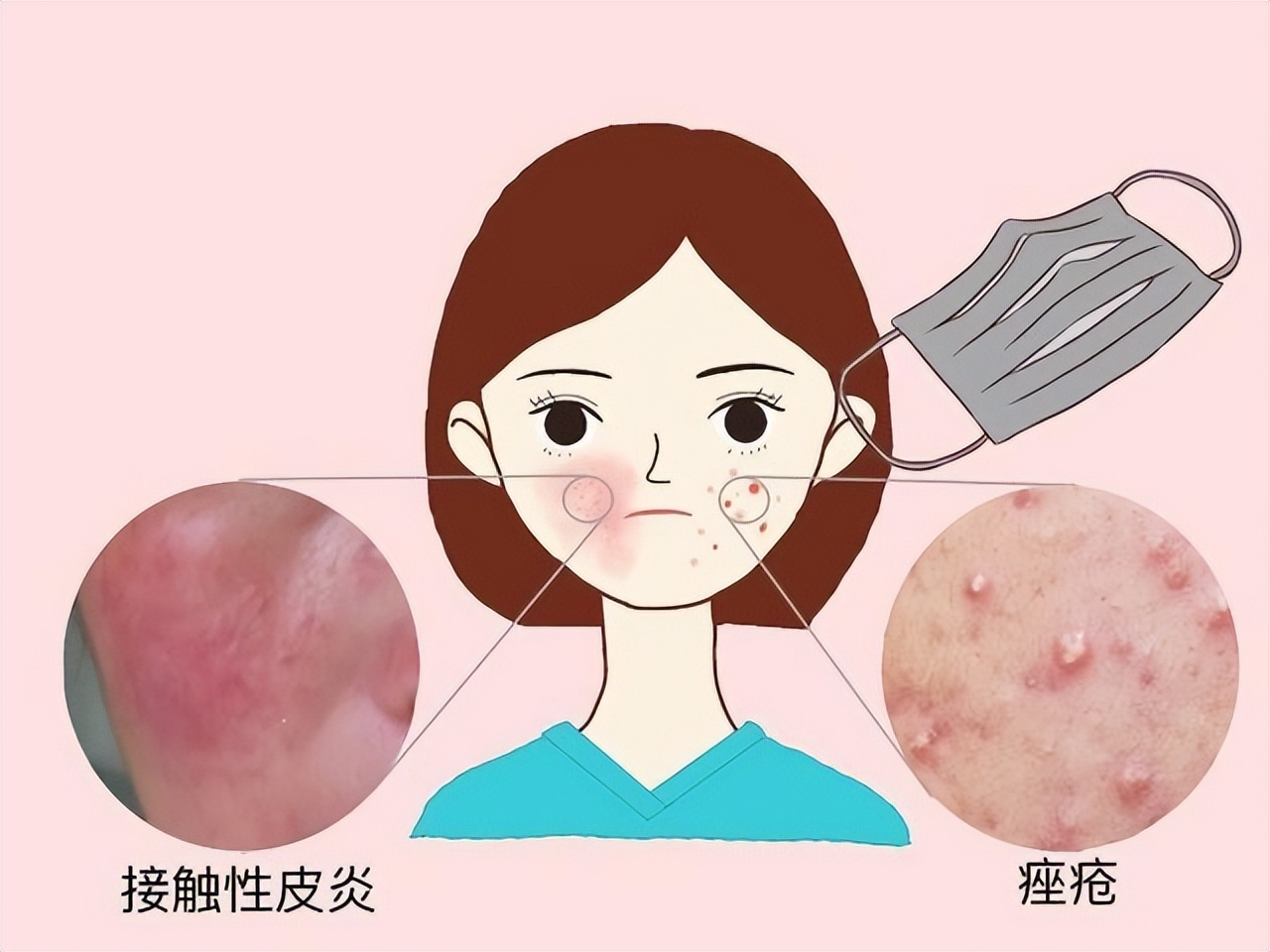 女子经常用艾叶洗头,艾叶煮水洗头副作用