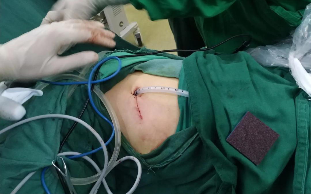 美国最新治疗肺癌特效药,治疗癌症需要的工具