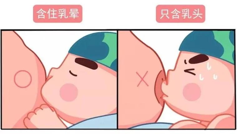 新生儿吐奶面部湿疹是过敏吗,宝宝身上起红点吐奶是怎么回事