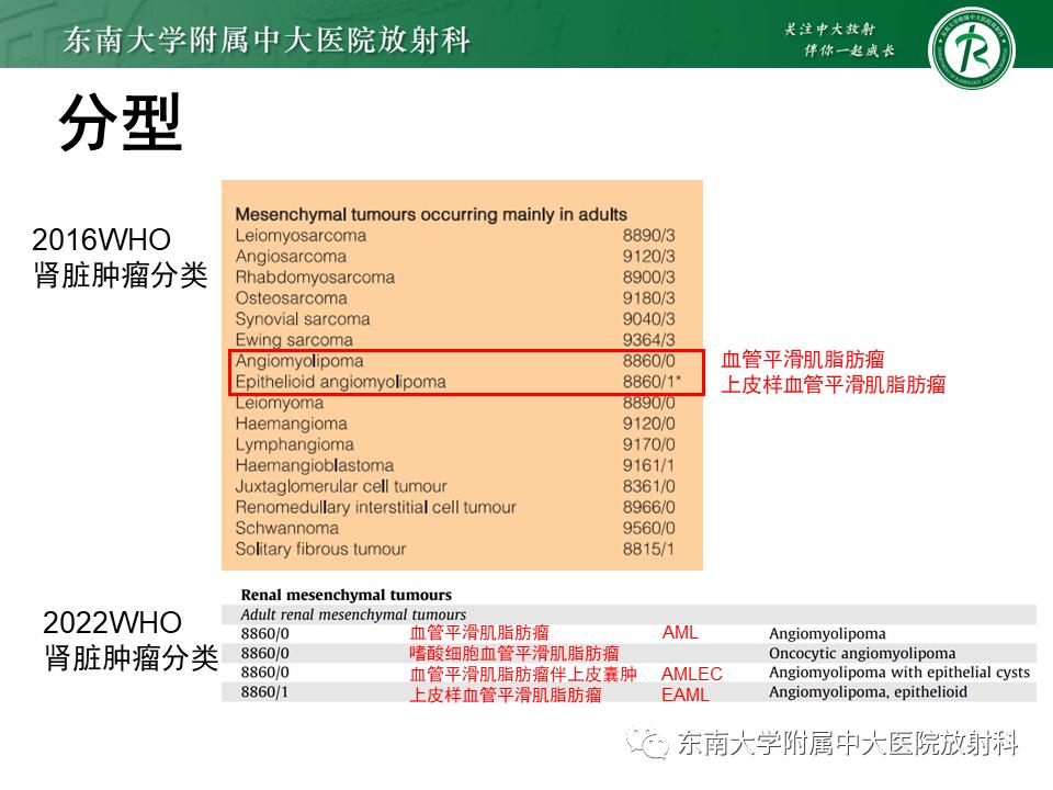 好文分享——《肾血管平滑肌脂肪瘤》