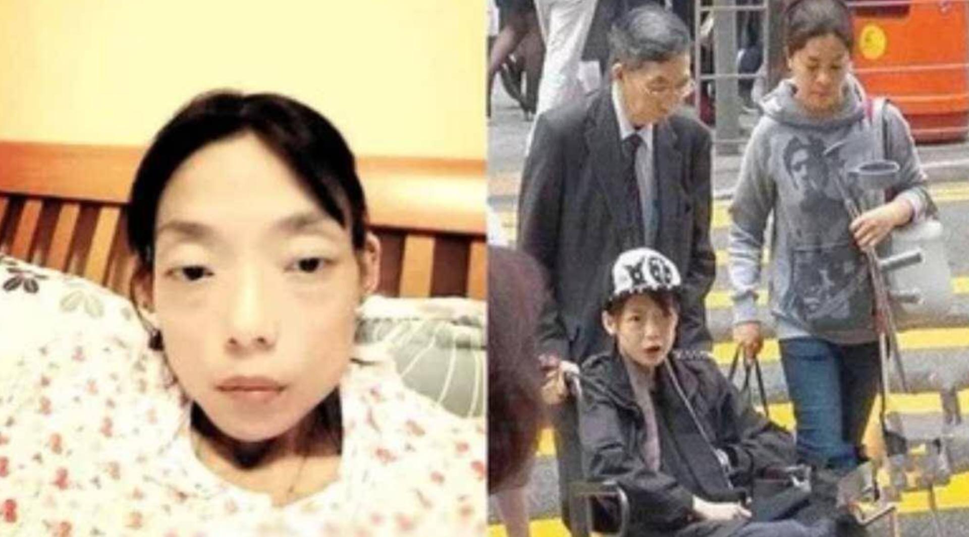 心慌、脱发、牙齿掉光，明星为瘦身花招百出，却被减肥后遗症折磨