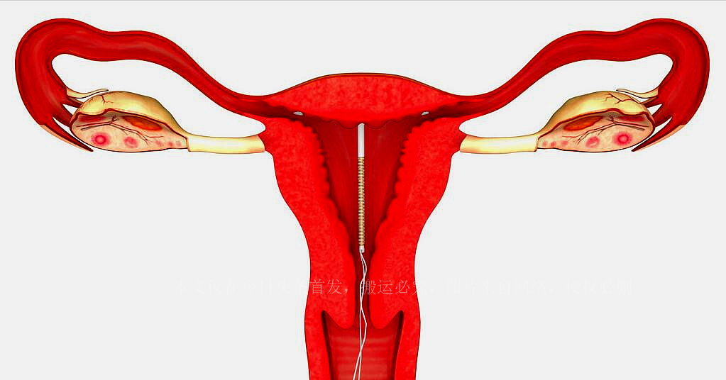 上环全过程及步骤,上环的详细过程