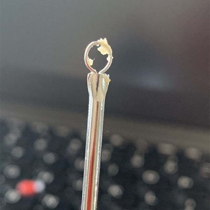 鼻子上挤出来的白色东西如何去除,鼻子上挤出来的白色分泌物是什么