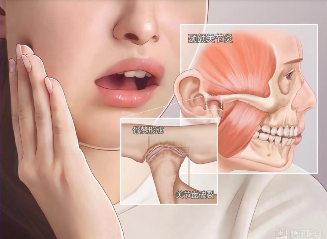 拔牙会影响听神经吗,拔牙影响我开宾利吗原版