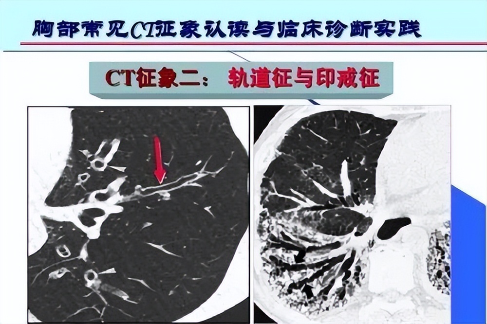 女性来大姨妈那么多血为啥不会死,有的女人一来姨妈就咯血