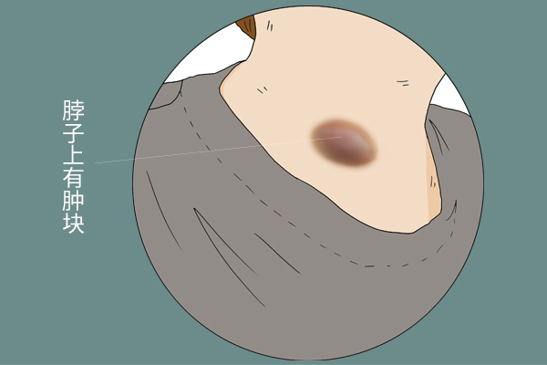 脖子腋下小肉粒怎么去除,脖子腋窝上的小肉粒怎么去除