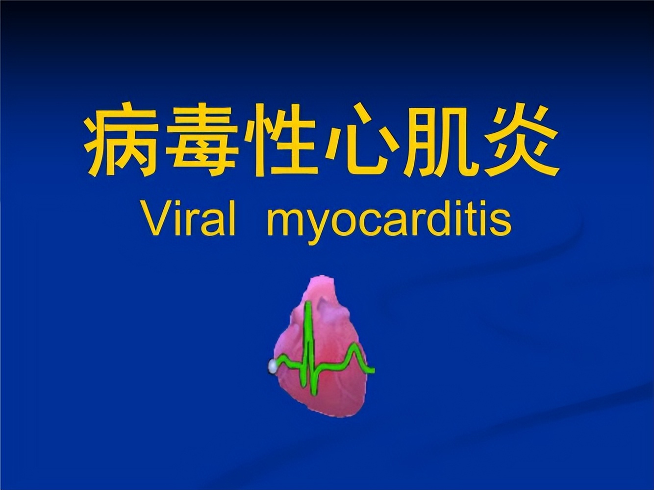 倪海厦讲经方治病毒性心肌炎,中医治疗病毒性心肌炎名医名方