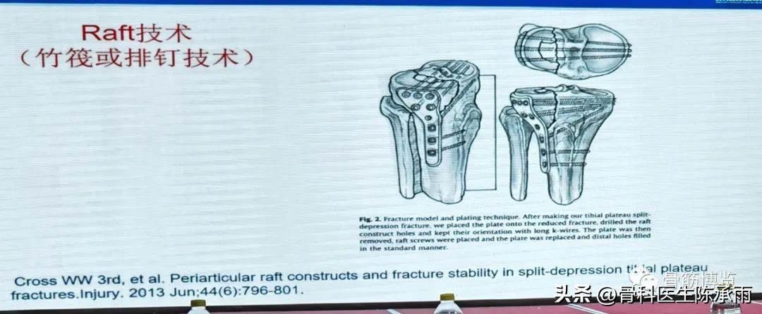 国家卫健委主办的骨创伤专项能力培训项目----下肢损伤学习班