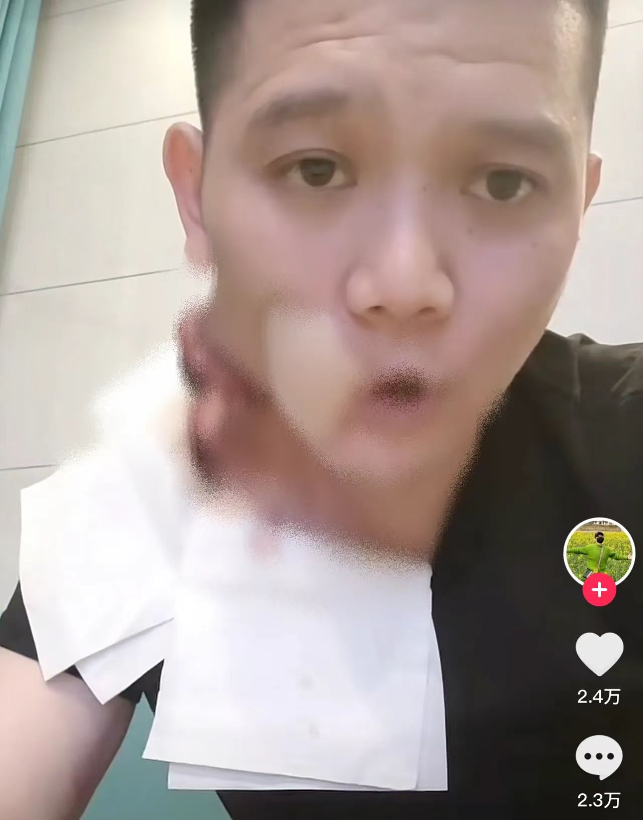 致癌食物87种一类致癌物名单,这7种食物吃了会致癌