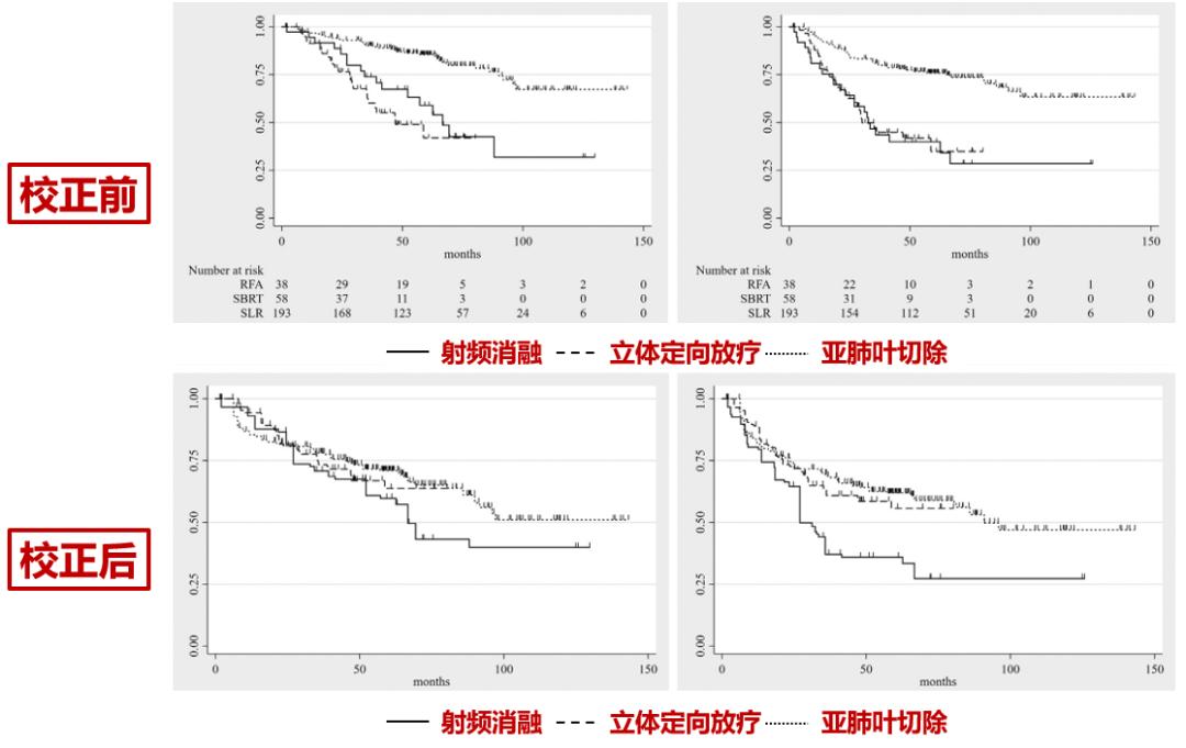 肺结节消融手术会留下后遗症吗,肺结节做消融术后还做放化疗吗