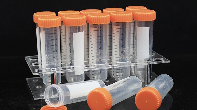 不孕不育检查前要做哪些准备,做不孕不育检查要提前做哪些准备