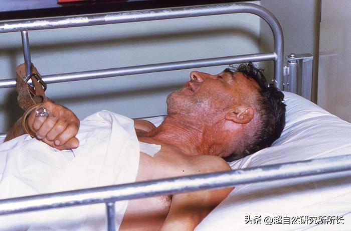 被狗咬了太可怕,被狗咬了才知道疼