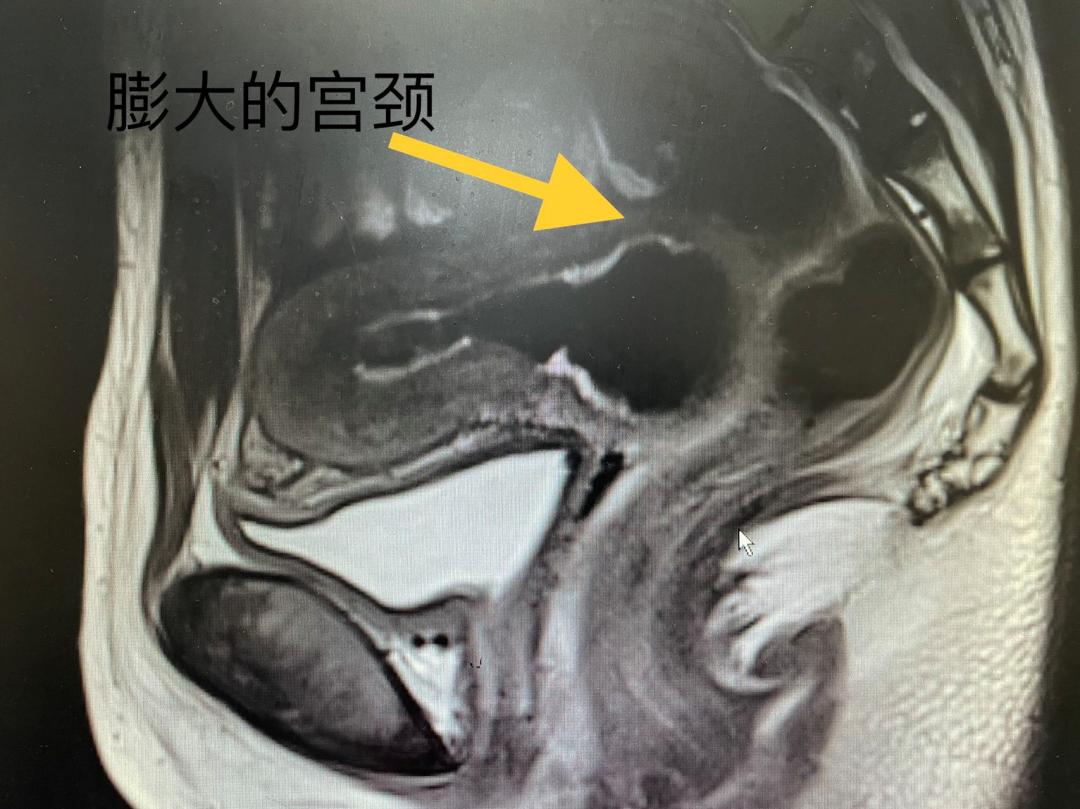 西安大兴医院妇一科,西安大兴医院妇科