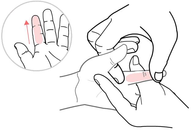 孩子咳嗽发烧反反复复是怎么回事,孩子咳嗽发烧的最佳治疗方法