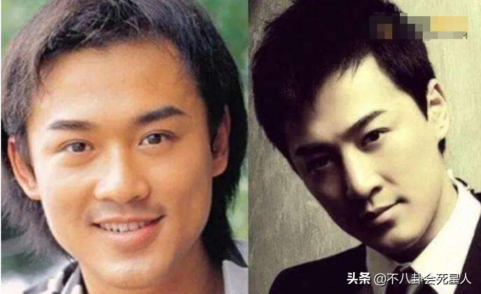 哪个女明星整容脸部变僵硬,整容脸vs自然脸的明星老去