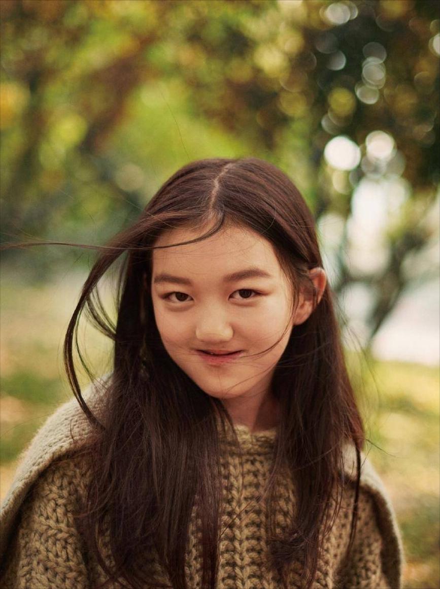 王菲女儿兔唇是什么原因造成的,王菲的女儿兔唇怎么治疗的