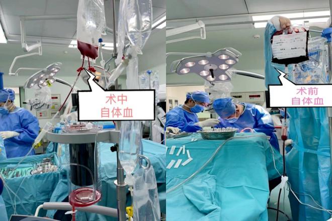 二次开颅遭遇意外风险,二次开颅手术能治好的概率大吗