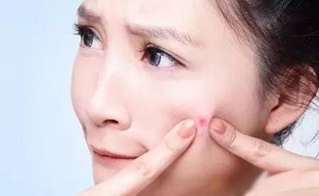 青春痘夏天能加重吗,冬天来了痘痘越来越多怎么办