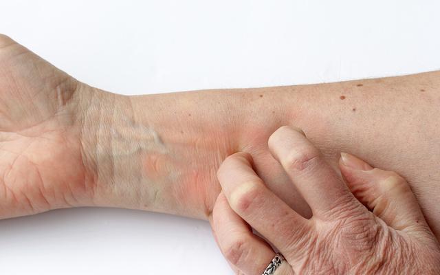 身上起红色小点点是不是hpv,身上有红色小血点跟hpv有关系吗